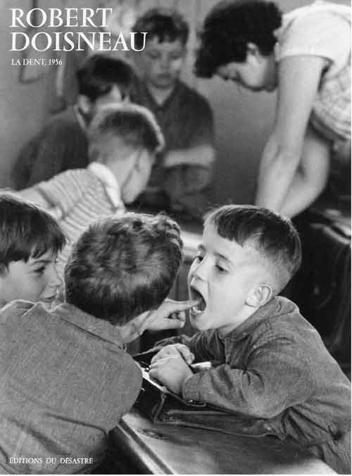 The Tooth, 1956 by Robert Doisneau - 24 X 32 Inches (Art Print)